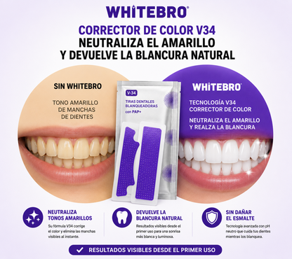 Tiras Blanqueadoras Dentales V34 (14 uds)