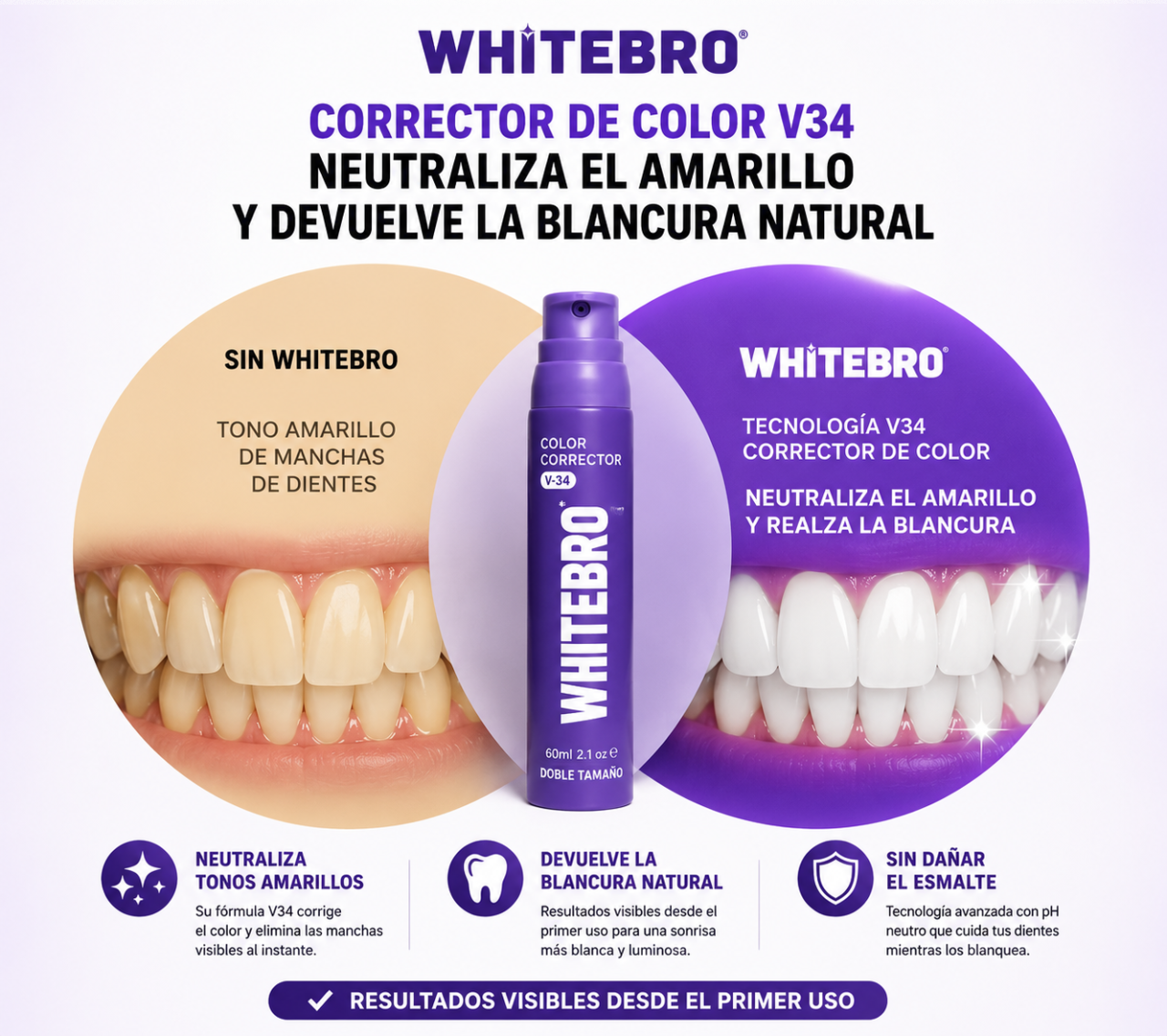 Blanqueador Dental V34 Whitebro