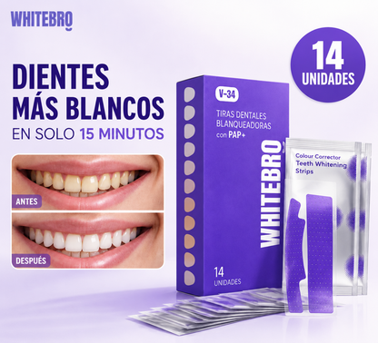 Tiras Blanqueadoras Dentales V34 (14 uds)
